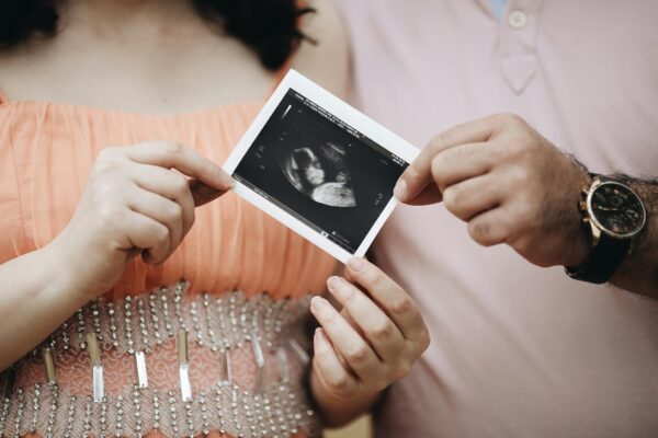 Close-up of a couple sharing an ultrasound photo, symbolizing pregnancy and family joy.